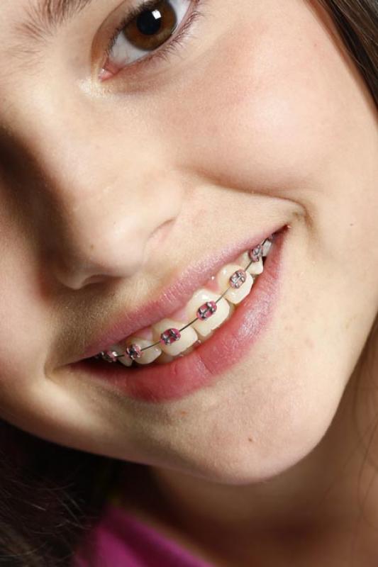 NiÃ±a Sonriendo con Frenos